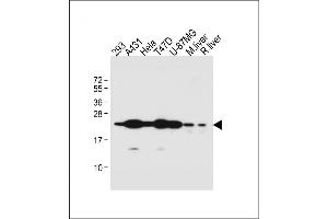 All lanes : Anti-RAB1B Antibody (C-term) at 1:1000 dilution Lane 1: 293 whole cell lysate Lane 2: A431 whole cell lysate Lane 3: Hela whole cell lysate Lane 4: T47D whole cell lysate Lane 5: U-87MG whole cell lysate Lane 6: Mouse liver lysate Lane 7: Rat liver lysate Lysates/proteins at 20 μg per lane.