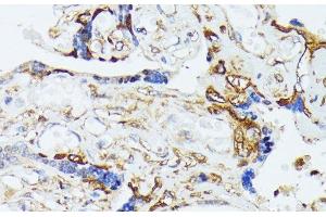 Immunohistochemistry of paraffin-embedded Human placenta using COX15 Polyclonal Antibody at dilution of 1:100 (40x lens).