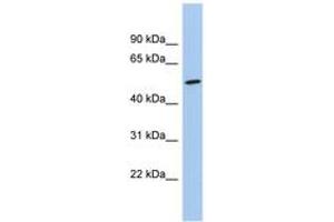 Image no. 1 for anti-Naked Cuticle Homolog 1 (NKD1) (C-Term) antibody (ABIN6744706) (NKD1 anticorps  (C-Term))
