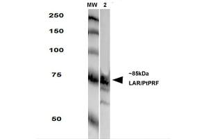 Western Blot analysis of Rat Brain Membrane showing detection of LAR protein using Mouse Anti-LAR Monoclonal Antibody, Clone S165-38 . (PTPRF anticorps  (AA 1315-1607))