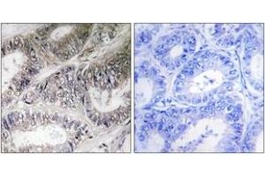 Immunohistochemistry analysis of paraffin-embedded human colon carcinoma tissue, using COX19 Antibody.