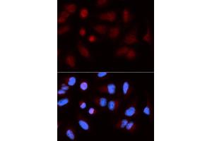 Immunofluorescence (IF) image for anti-SH2B Adaptor Protein 1 (SH2B1) antibody (ABIN1876744) (SH2B1 anticorps)