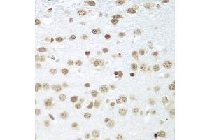 Immunohistochemistry of paraffin-embedded mouse brain using SAP18 antibody at dilution of 1:100 (40x lens). (SAP18 anticorps)