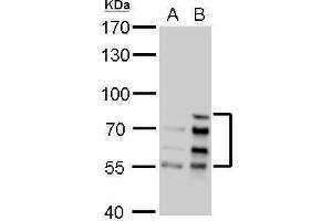 WB Image Lamin A + C antibody detects Lamin A + C protein by Western blot analysis. (Lamin A/C anticorps)