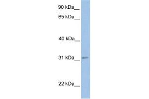 WB Suggested Anti-ECHDC2 Antibody Titration:  0. (ECHDC2 anticorps  (Middle Region))