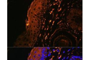 Immunofluorescence analysis of Rat skin cells using TGM1 Polyclonal Antibody at dilution of 1:100.