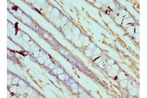 Immunohistochemistry of paraffin-embedded human colon tissue using ABIN7146544 at dilution of 1:100 (Calpain 3 anticorps  (AA 582-821))