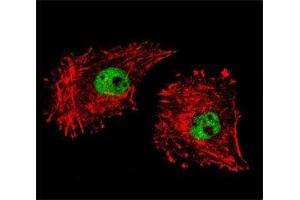 Confocal immunofluorescent analysis of FUS antibody with MDA-MB231 cells followed by Alexa Fluor 488-conjugated goat anti-rabbit lgG (green).