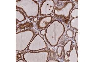 Immunohistochemical staining of human thyroid gland with UFSP2 polyclonal antibody  shows strong cytoplasmic and nuclear positivity in glandular cells at 1:500-1:1000 dilution. (UFSP2 anticorps)