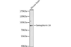 Western blot analysis of extracts of mouse brain, using Semaphorin 3A antibody (ABIN6134919, ABIN6147507, ABIN6147509 and ABIN6216796) at 1:3000 dilution. (SEMA3A anticorps  (AA 300-400))