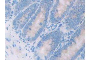 DAB staining on IHC-P; Samples: Rat Small intestine Tissue
