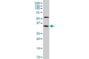 ZIC4 monoclonal antibody (M12), clone 3G4 Western Blot analysis of ZIC4 expression in Jurkat . (ZIC4 anticorps  (AA 1-90))