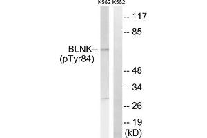 Western blot analysis of extracts from K562 cells, treated with starved (24hours), using BLNK (Phospho-Tyr84) antibody. (B-Cell Linker anticorps  (pTyr84))
