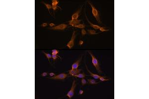 Immunofluorescence analysis of C6 cells using GST Rabbit pAb (8266) at dilution of 1:100 (40x lens). (GSTA1 anticorps  (AA 1-222))