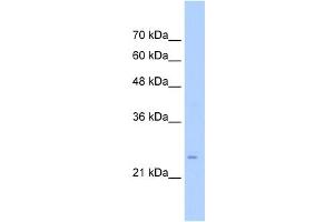 WB Suggested Anti-TMEM69 Antibody Titration:  0. (TMEM69 anticorps  (Middle Region))