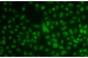 Immunofluorescence analysis of A549 cells using KLF3 Polyclonal Antibody (KLF3 anticorps)