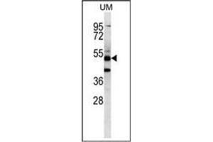 Western blot analysis of PNLIPRP3 Antibody (N-term) Cat. (PNLIPRP3 anticorps  (N-Term))
