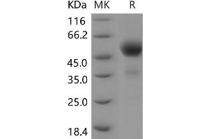 Western Blotting (WB) image for T Cell Immunoreceptor with Ig and ITIM Domains (TIGIT) (Active) protein (Fc Tag) (ABIN7320105)