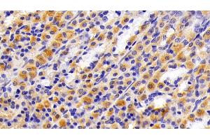 Detection of CK7 in Rat Stomach Tissue using Polyclonal Antibody to Cytokeratin 7 (CK7)