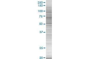 SERPING1 transfected lysate. (SERPING1 293T Cell Transient Overexpression Lysate(Denatured))