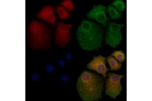 ABIN6261285 and ABIN6276758 staining Hela cells by IF/ICC. (Dihydrofolate Reductase anticorps  (N-Term))