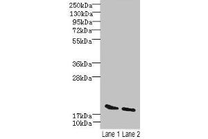 Western blot All lanes: SKP1 antibody at 15 μg/mL Lane 1: Mouse brain tissue Lane 2: Hela whole cell lysate Secondary Goat polyclonal to rabbit IgG at 1/10000 dilution Predicted band size: 19 kDa Observed band size: 19 kDa (SKP1 anticorps  (AA 2-163))