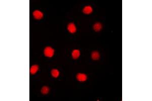 Immunofluorescent analysis of Separase (pS801) staining in MDAMB231 cells.