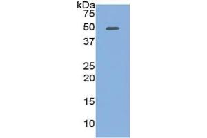 WB of Protein Standard: different control antibodies against Highly purified E. (PCOLCE Kit ELISA)