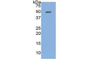 WB of Protein Standard: different control antibodies against Highly purified E. (PCOLCE Kit ELISA)