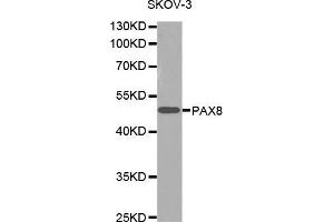 Western blot analysis of extracts of SKOV-3 cells lines, using PAX8 antibody.