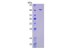 Image no. 1 for Sialidase 1 (Lysosomal Sialidase) (NEU1) (AA 47-415) (Active) protein (His tag) (ABIN5665884)