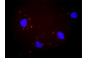 Proximity Ligation Analysis of protein-protein interactions between PTK2 and ITGAV.