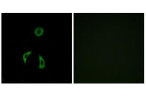 Immunofluorescence analysis of A549 cells, using FZD3 antibody. (FZD3 anticorps  (Internal Region))