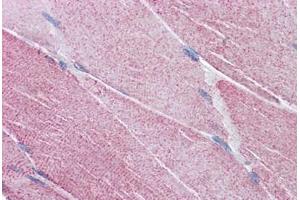Human Skeletal Muscle: Formalin-Fixed, Paraffin-Embedded (FFPE) (PCSK6 anticorps  (AA 637-648))