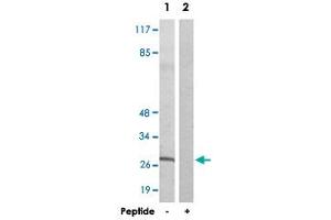 Western blot analysis of extracts from NIH/3T3 cells, using KDELR3 polyclonal antibody .