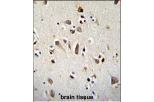 anti-Orthodenticle Homeobox 2 (OTX2) (AA 261-289), (C-Term) antibody