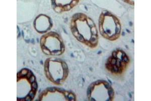 IHC-P analysis of kidney tissue, with DAB staining.