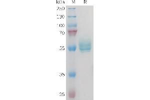 Mouse TN Protein, hFc Tag on SDS-PAGE under reducing condition.