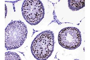 IHC analysis of MED8 using anti-MED8 antibody . (MED8 anticorps  (AA 1-195))