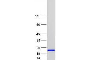 Validation with Western Blot