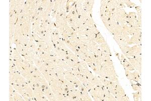 anti-Small Nuclear Ribonucleoprotein 200kDa (U5) (SNRNP200) (C-Term) antibody
