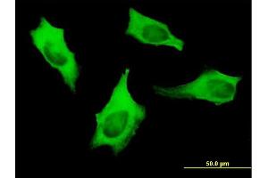 Immunofluorescence of monoclonal antibody to MYH9 on HeLa cell.