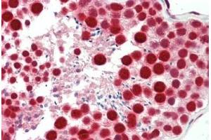 Human Testis: Formalin-Fixed, Paraffin-Embedded (FFPE) (TARDBP anticorps  (AA 1-30))