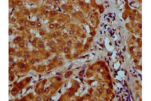 IHC image of ABIN7160724 diluted at 1:200 and staining in paraffin-embedded human liver tissue performed on a Leica BondTM system.