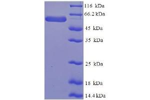 SDS-PAGE (SDS) image for serpin Peptidase Inhibitor, Clade B (Ovalbumin), Member 1 (SERPINB1) (AA 1-379), (full length) protein (His-SUMO Tag) (ABIN5710338)