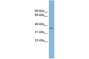 WB Suggested Anti-TMPRSS12 Antibody Titration: 0. (TMPRSS12 anticorps  (Middle Region))