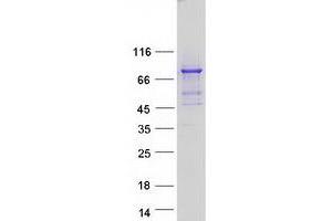 Validation with Western Blot