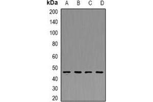 Western blot analysis of PDK4 expression in THP1 (A), Hela (B), mouse kidney (C), mouse heart (D) whole cell lysates. (PDK4 anticorps)
