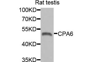 Western blot analysis of extracts of rat testis, using CPA6 antibody. (CPA6 anticorps)