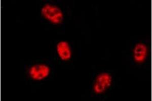 ABIN6276437 staining HEPG2 cells by ICC/IF. (BIRC2 anticorps  (C-Term))